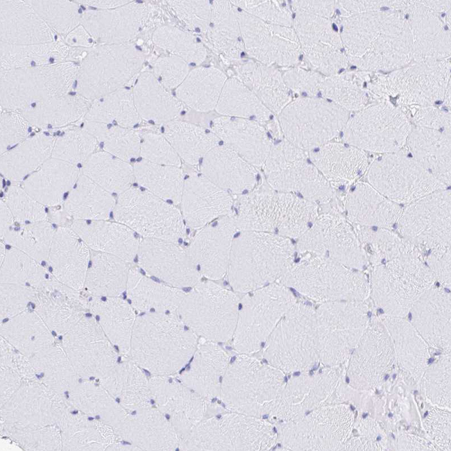 CD7 Antibody in Immunohistochemistry (Paraffin) (IHC (P))