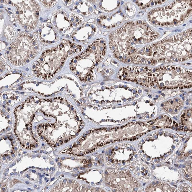 RISC Antibody in Immunohistochemistry (Paraffin) (IHC (P))