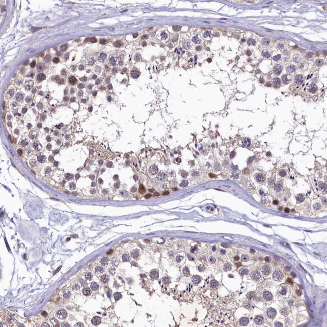LATS2 Antibody in Immunohistochemistry (Paraffin) (IHC (P))