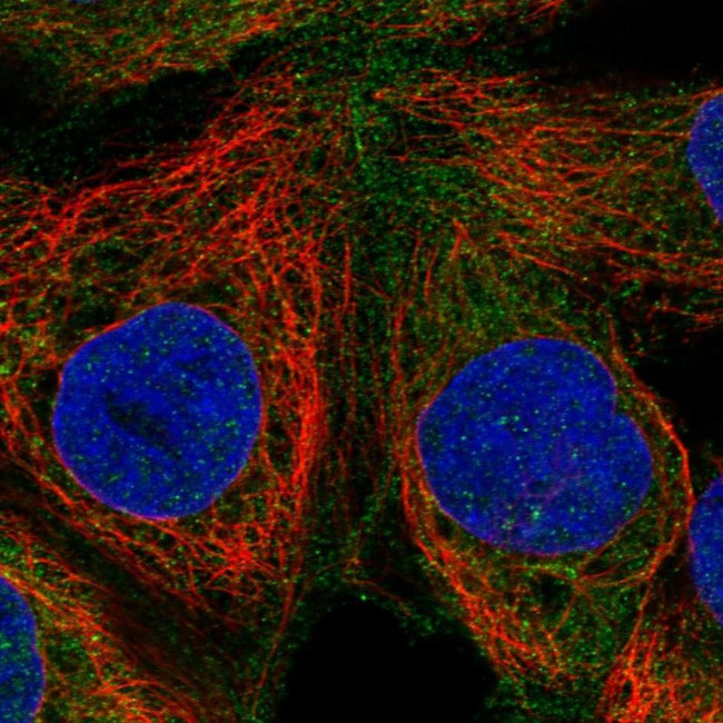 RASGRP1 Antibody in Immunocytochemistry (ICC/IF)