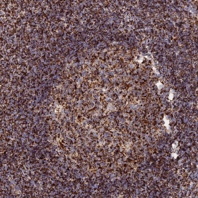 HICE1 Antibody in Immunohistochemistry (Paraffin) (IHC (P))