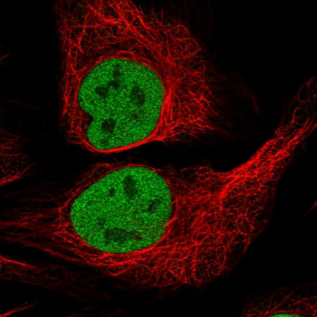 p70 S6 Kinase Antibody in Immunocytochemistry (ICC/IF)