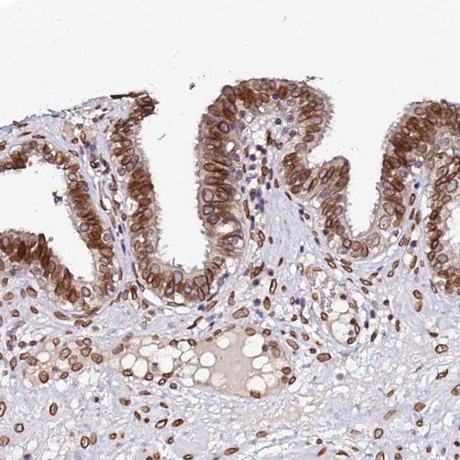 APC5 Antibody in Immunohistochemistry (Paraffin) (IHC (P))