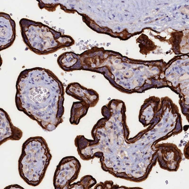 PACSIN3 Antibody in Immunohistochemistry (Paraffin) (IHC (P))