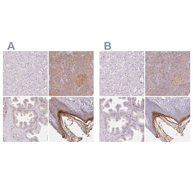 BLMH Antibody in Immunohistochemistry (Paraffin) (IHC (P))