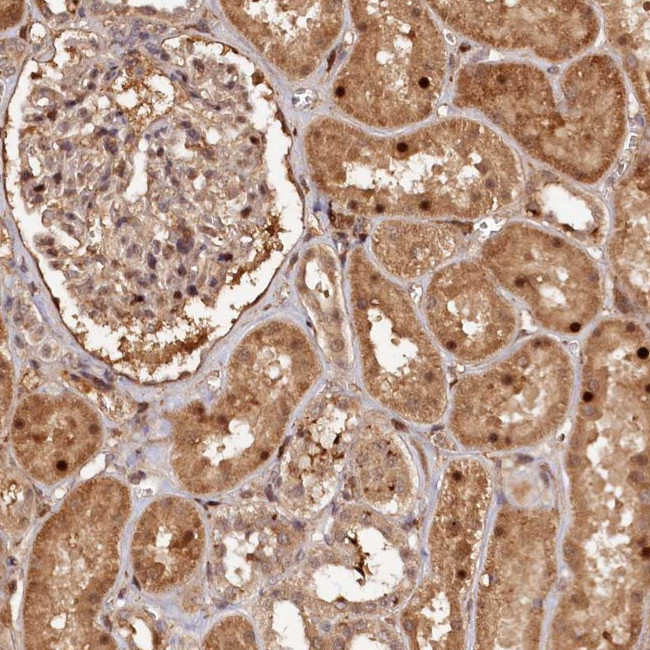 TRAPPC4 Antibody in Immunohistochemistry (Paraffin) (IHC (P))