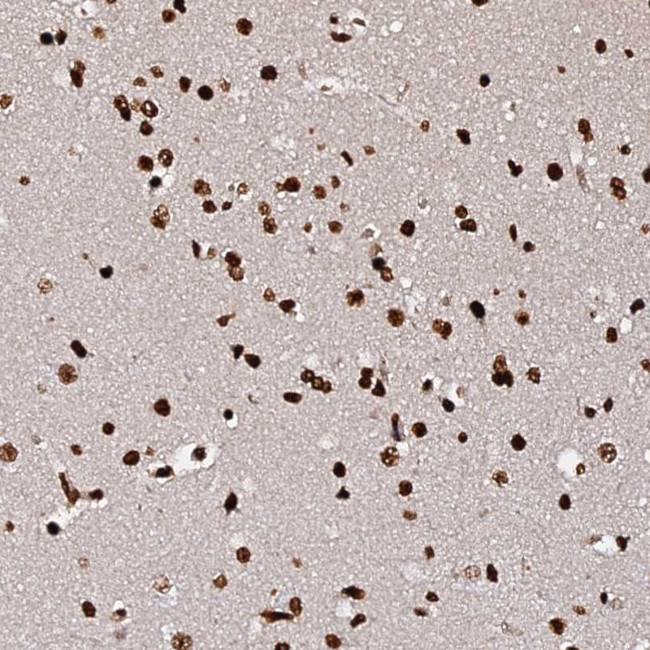 DNAH10OS Antibody in Immunohistochemistry (Paraffin) (IHC (P))