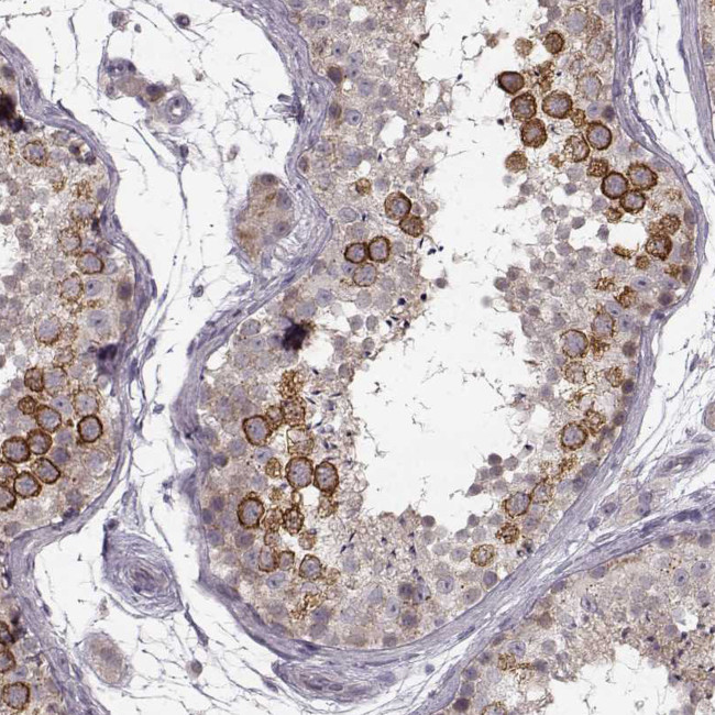 RHAMM Antibody in Immunohistochemistry (Paraffin) (IHC (P))