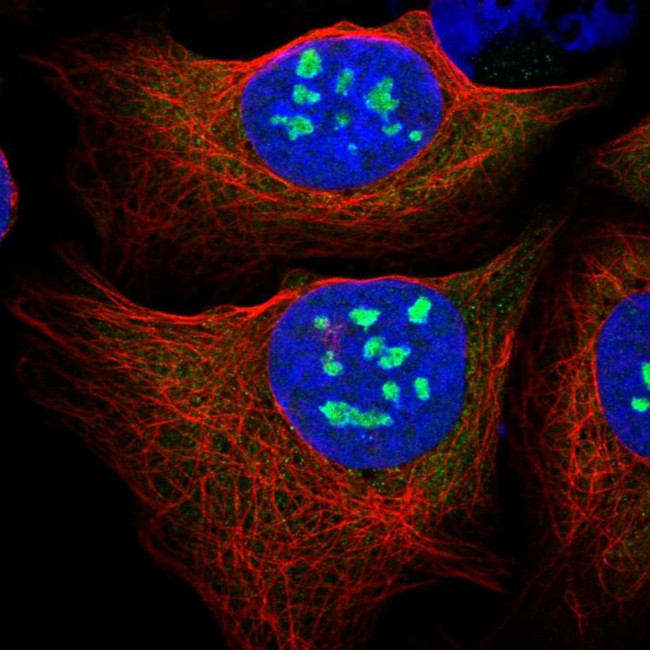 PES1 Antibody in Immunocytochemistry (ICC/IF)
