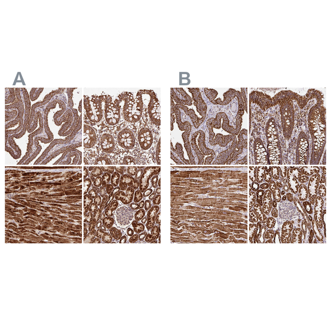 ATP5A1 Antibody in Immunohistochemistry (Paraffin) (IHC (P))