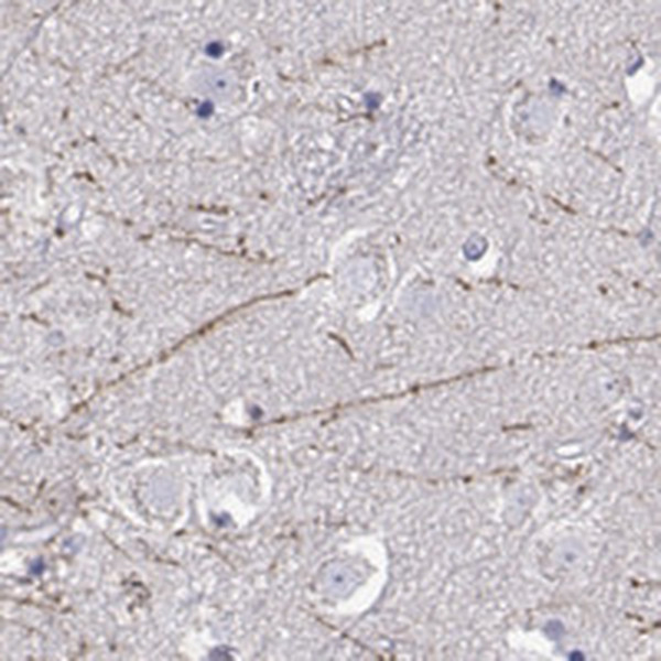 DCLK3 Antibody in Immunohistochemistry (Paraffin) (IHC (P))