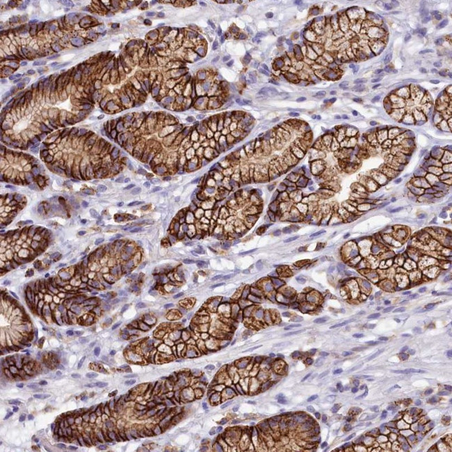 HPS6 Antibody in Immunohistochemistry (Paraffin) (IHC (P))