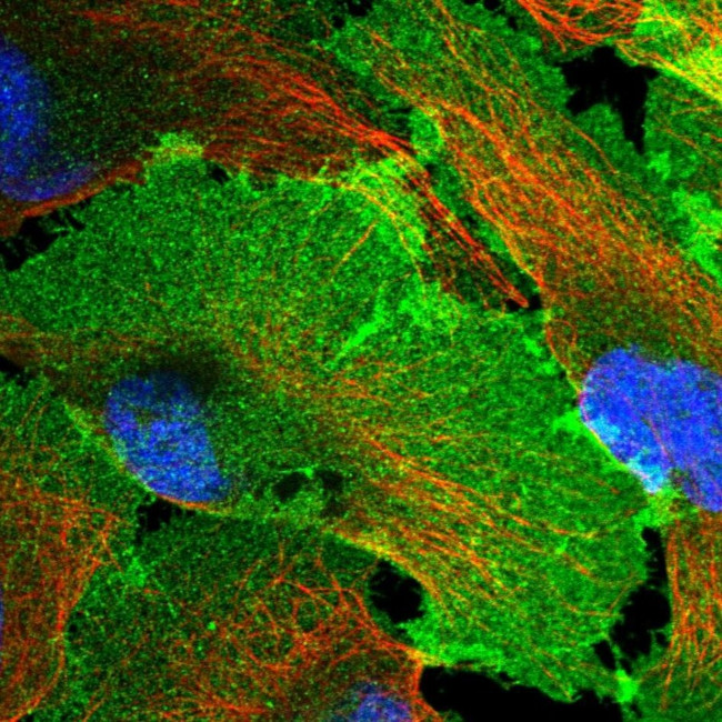 GNB4 Antibody in Immunocytochemistry (ICC/IF)