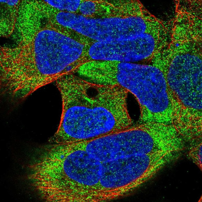 TSR3 Antibody in Immunocytochemistry (ICC/IF)