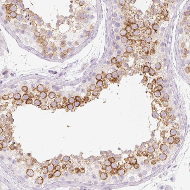 TSP50 Antibody in Immunohistochemistry (Paraffin) (IHC (P))