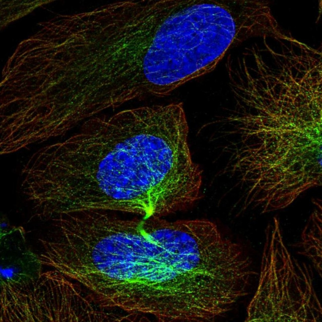 CIS Antibody in Immunocytochemistry (ICC/IF)