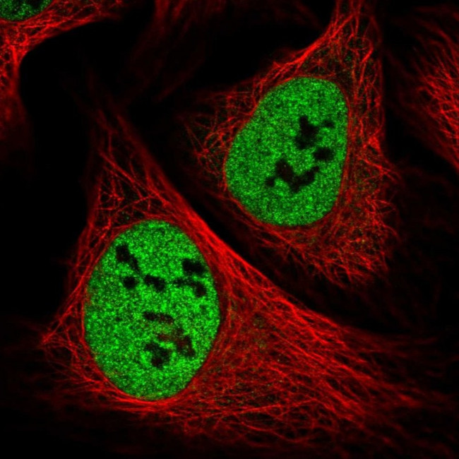 PPP4R1 Antibody in Immunocytochemistry (ICC/IF)