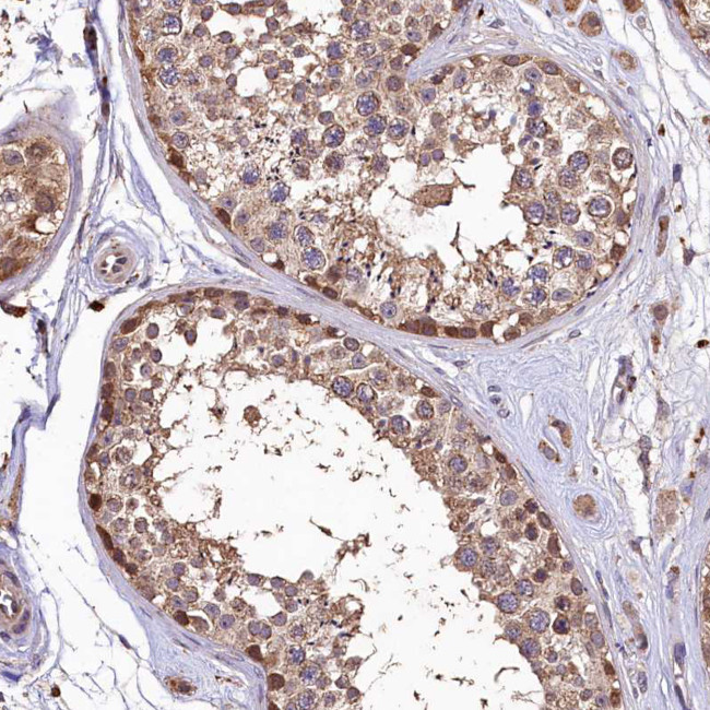 LSM4 Antibody in Immunohistochemistry (Paraffin) (IHC (P))