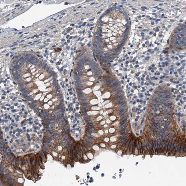 GLUT10 Antibody in Immunohistochemistry (Paraffin) (IHC (P))