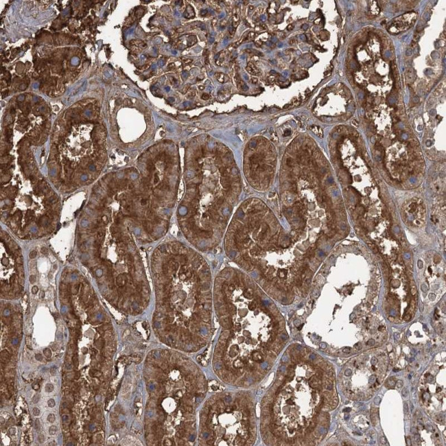 KID Antibody in Immunohistochemistry (Paraffin) (IHC (P))