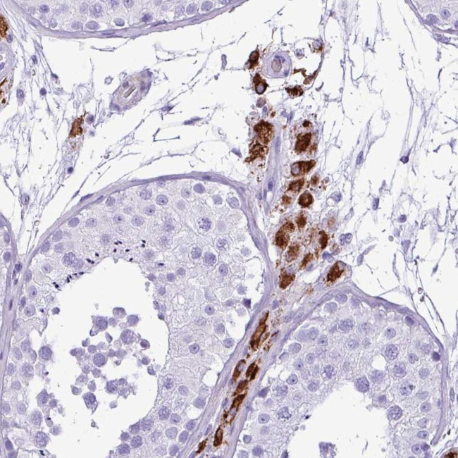 ZSCAN5 Antibody in Immunohistochemistry (Paraffin) (IHC (P))