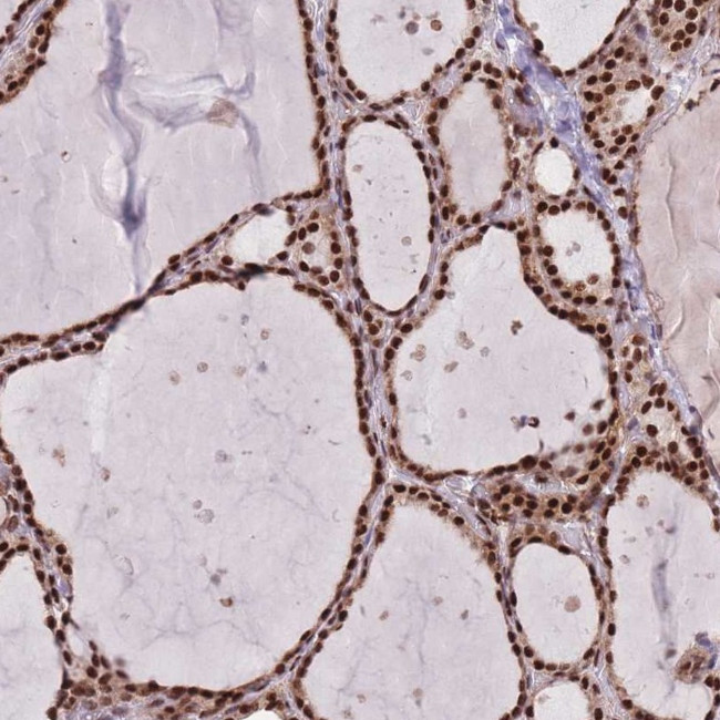 DNAJC3 Antibody in Immunohistochemistry (Paraffin) (IHC (P))
