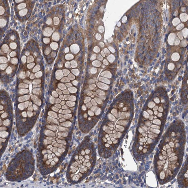 Adenylate Cyclase 9 Antibody in Immunohistochemistry (Paraffin) (IHC (P))