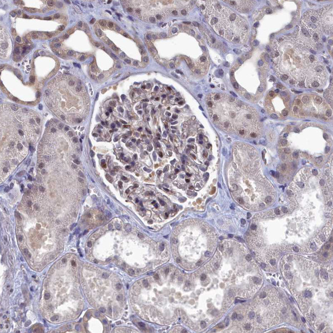 Ubiquitin C Antibody in Immunohistochemistry (Paraffin) (IHC (P))