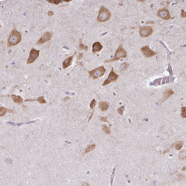LRRC9 Antibody in Immunohistochemistry (Paraffin) (IHC (P))