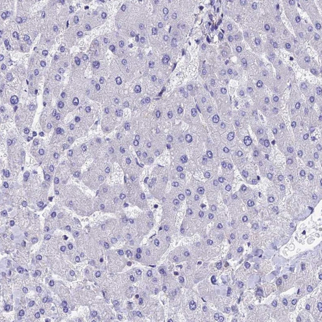 Septin 1 Antibody in Immunohistochemistry (Paraffin) (IHC (P))
