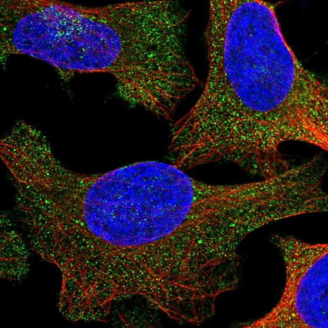 UBAP1 Antibody in Immunocytochemistry (ICC/IF)