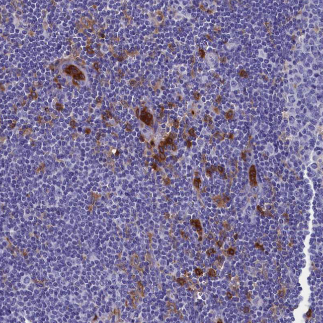 TYROBP Antibody in Immunohistochemistry (Paraffin) (IHC (P))