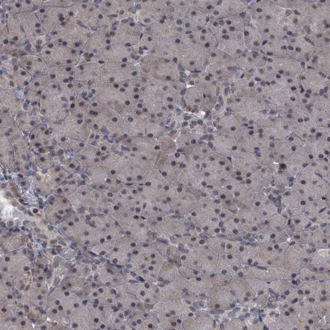 SAE1 Antibody in Immunohistochemistry (Paraffin) (IHC (P))