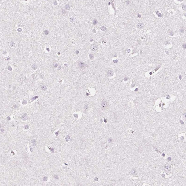 EHHADH Antibody in Immunohistochemistry (Paraffin) (IHC (P))