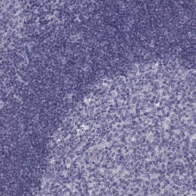 PDZRN4 Antibody in Immunohistochemistry (Paraffin) (IHC (P))