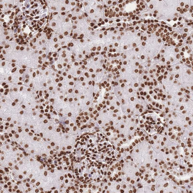 HIST1H2BD Antibody in Immunohistochemistry (Paraffin) (IHC (P))