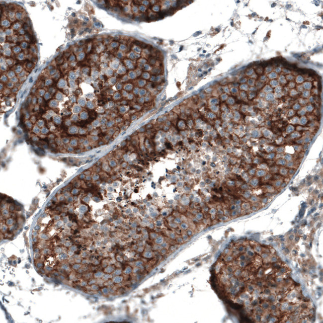 SEMA7A Antibody in Immunohistochemistry (Paraffin) (IHC (P))