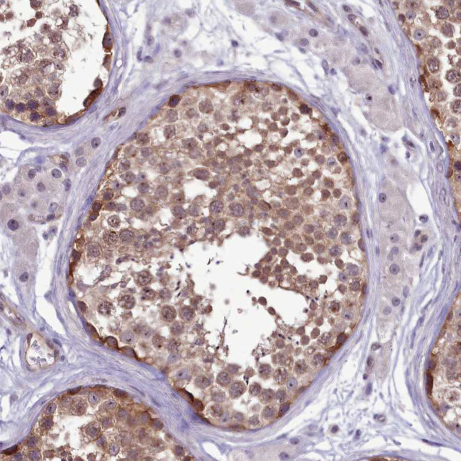 p130Cas Antibody in Immunohistochemistry (Paraffin) (IHC (P))