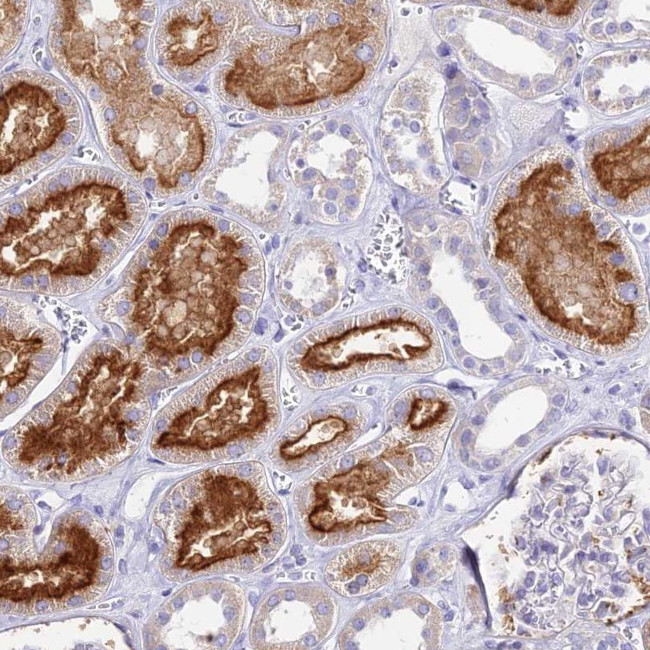 TMEM78 Antibody in Immunohistochemistry (Paraffin) (IHC (P))