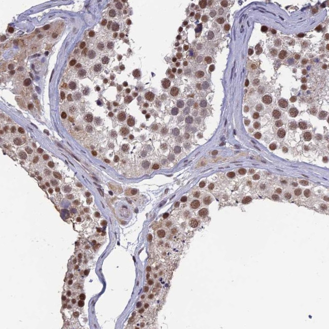 MRG15 Antibody in Immunohistochemistry (Paraffin) (IHC (P))