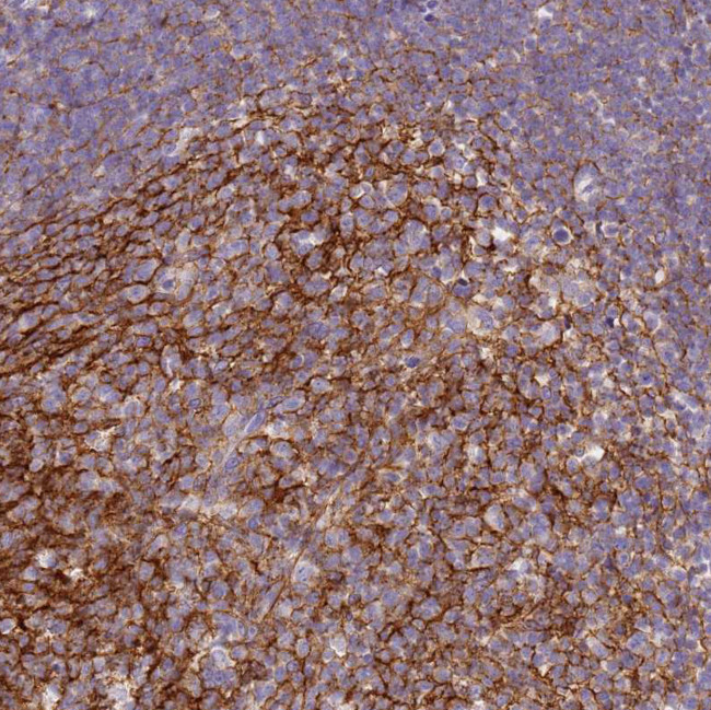 CD35 Antibody in Immunohistochemistry (Paraffin) (IHC (P))