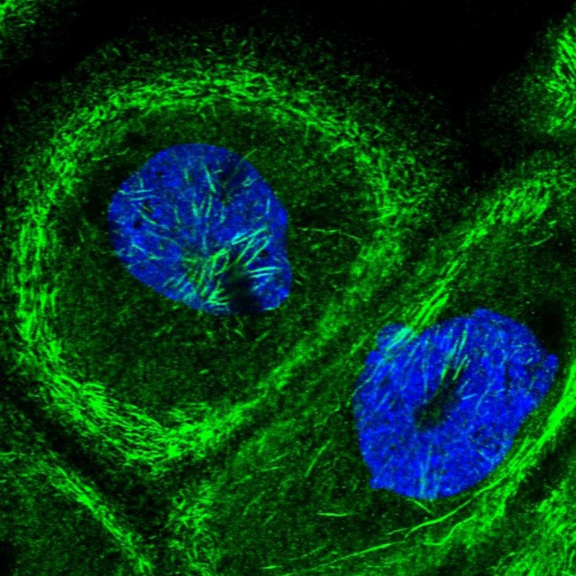 Septin-9 Antibody in Immunocytochemistry (ICC/IF)