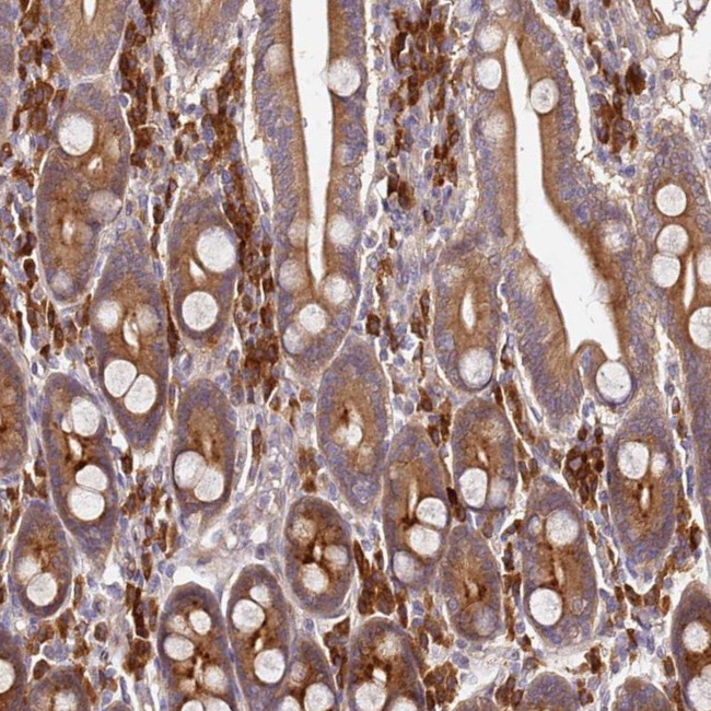 ORP2 Antibody in Immunohistochemistry (Paraffin) (IHC (P))