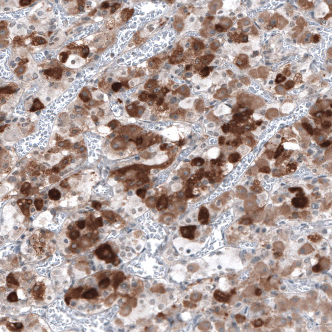 TSH beta Antibody in Immunohistochemistry (Paraffin) (IHC (P))