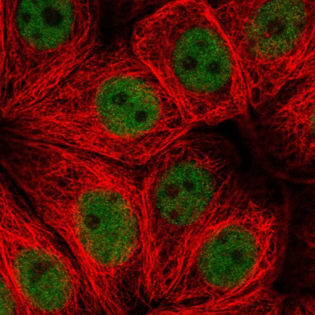 ZNF821 Antibody in Immunocytochemistry (ICC/IF)