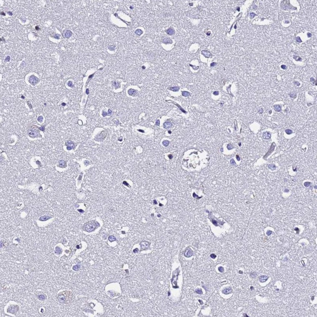 S100A11 Antibody in Immunohistochemistry (Paraffin) (IHC (P))