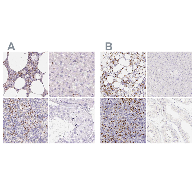 PADI4 Antibody in Immunohistochemistry (Paraffin) (IHC (P))