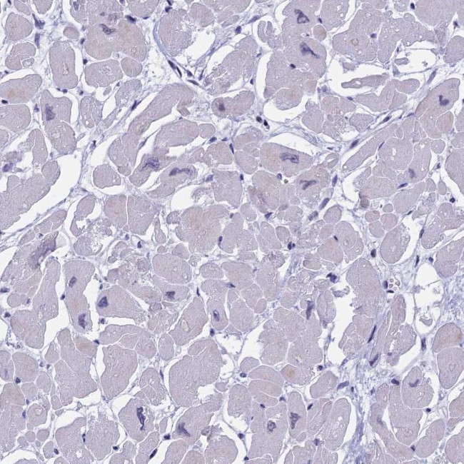 MYBPC2 Antibody in Immunohistochemistry (Paraffin) (IHC (P))