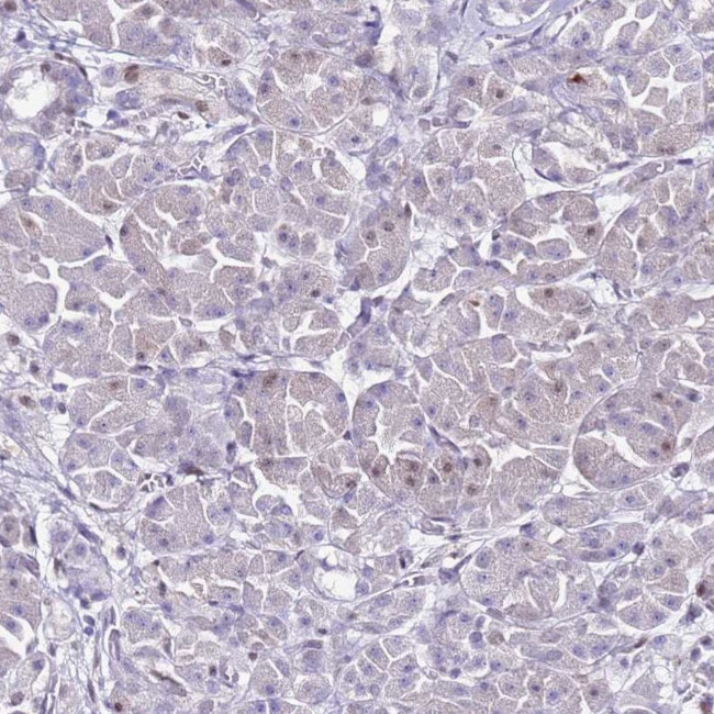 KPNA4 Antibody in Immunohistochemistry (Paraffin) (IHC (P))