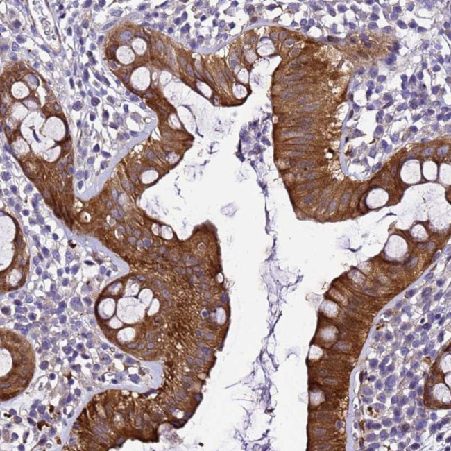 ZNF587 Antibody in Immunohistochemistry (Paraffin) (IHC (P))